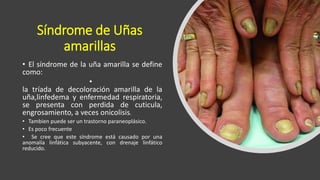 Síndrome de Uñas
amarillas
• El síndrome de la uña amarilla se define
como:
•
la tríada de decoloración amarilla de la
uña,linfedema y enfermedad respiratoria,
se presenta con perdida de cuticula,
engrosamiento, a veces onicolisis.
• Tambien puede ser un trastorno paraneoplásico.
• Es poco frecuente
• Se cree que este síndrome está causado por una
anomalía linfática subyacente, con drenaje linfático
reducido.
 