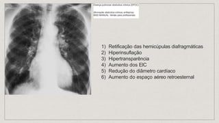 Semiologia Aparelho Respiratório.pptx