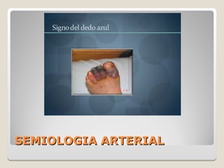 SEMIOLOGIA ARTERIALSEMIOLOGIA ARTERIAL
 