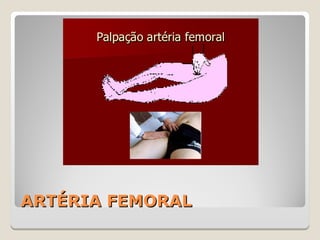 ARTÉRIA FEMORALARTÉRIA FEMORAL
 