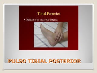 PULSO TIBIAL POSTERIORPULSO TIBIAL POSTERIOR
 