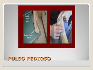 PULSO PEDIOSOPULSO PEDIOSO
 