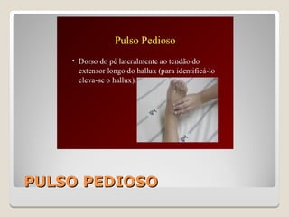PULSO PEDIOSOPULSO PEDIOSO
 