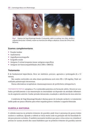 22 Semiologia Básica em Oftalmologia
Fig.1 Doença de Vogt-Koyanagi-Harada. À esquerda, veêm-se poliose nos cílios, atrofia e
cegueira binocular. À direita, notam-se manchas de vitiligo e alopecia. (Casos da Clínica Prof.
Moreira).
Exames complementares
■ Punção lombar
■ Audiometria
■ Angiofluoresceinografia
■ Ecografia ocular
■ Antígeno S retinal (resposta imune antígeno-específica)
■ Antígeno de histocompatibilidade (HLA DR4 e DRW53)
Tratamento
r
E de fundamental importância. Deve ser sistêmico, precoce, agressivo e prolongado (6 a 12
meses).
São usados corticoides em altas doses (prednisona oral entre 80 e 120 mg/dia). Pode ser
realizada pulsoterapia intravenosa.
Outras alternativas terapêuticas: imunossupressores de preferência ciclosporina A.
TRATAMENTOTÓPICO: atropina a %e corticoides potentes em forma de colírio. Devem ser ava­
liados periodicamente e sua manutenção ou intensidade vai depender da atividade inflamató­
ria do segmento anterior. Avaliar pressão intraocular, exsudação e aderências da úvea anterior.
A síndrome de Vogt-Koyamagi-Harada é doença grave de evolução variável e o tratamento
tardio pode ser pouco eficiente para evitar sequelas graves e inclusive a cegueira binocular.
RUBÉOLA MATERNA
A rubéola materna no primeiro trimestre de gravidez pode levar à presença de graves lesões
oculares e auditivas. Quando a rubéola se inicia muito cedo na gestação não há imunidade fe­
tal para prevenir as lesões. É também necessário lembrar que para o vírus entrar no cristalino é
preciso ter acesso através dos vasos hialóideos que no primeiro trimestre de gravidez nutrem
 
