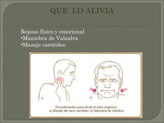 Reposo físico y emocional Maniobra de Valsalva  Masaje carotídeo QUE  LO ALIVIA 