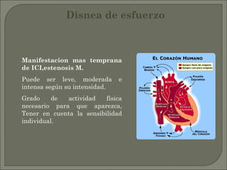 Disnea de esfuerzo Manifestacion mas temprana de ICI,estenosis M. Puede ser leve, moderada e intensa según su intensidad. Grado de actividad física necesario para que aparezca, Tener en cuenta la sensibilidad individual. 