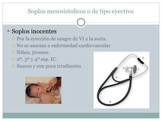 Soplos mesosistolicos o de tipo eyectivo Soplos inocentes Por la eyección de sangre de VI a la aorta. No se asocian a enfermedad cardiovascular Niños, jóvenes  2º, 3º y 4º esp. IC. Suaves y con poca irradiación 