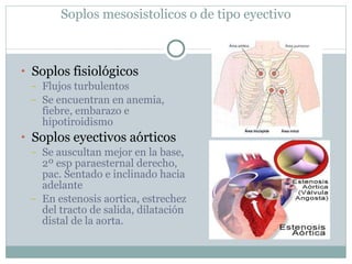 Soplos mesosistolicos o de tipo eyectivo Soplos fisiológicos Flujos turbulentos Se encuentran en anemia, fiebre, embarazo e hipotiroidismo Soplos eyectivos aórticos Se auscultan mejor en la base, 2º esp paraesternal derecho, pac. Sentado e inclinado hacia adelante En estenosis aortica, estrechez del tracto de salida, dilatación distal de la aorta. 