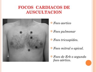 FOCOS CARDIACOS DE
AUSCULTACION
 Foco aortico
 Foco pulmonar
 Foco tricuspídeo.
 Foco mitral o apical.
 Foco de Erb o segundo
foco aórtico.
 