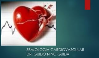 SEMIOLOGIA CARDIOVASCULAR
DR. GUIDO NINO GUIDA
 