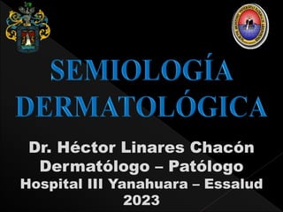 Dr. Héctor Linares Chacón
Dermatólogo – Patólogo
Hospital III Yanahuara – Essalud
2023
 