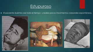 Estupuroso 
 El paciente duerme casi todo el tiempo y realiza pocos movimientos corporales espontáneos. 
 