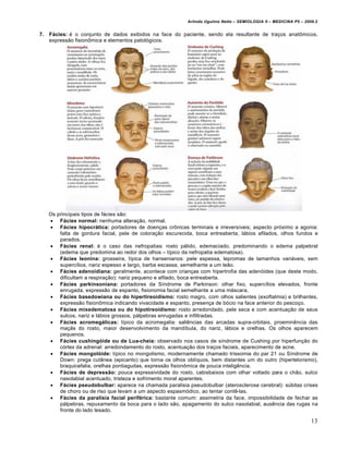 Arlindo Ugulino Netto – SEMIOLOGIA II – MEDICINA P5 – 2009.2


7.   Fácies: € o conjunto de dados exibidos na face do paciente, sendo ela resultante de tra•os anat•micos,
     express…o fision•mica e elementos patol‚gicos.




     Os principais tipos de f„cies s…o:
      Fácies normal: nenhuma altera•…o, normal.
      Fácies hipocrática: portadores de doen•as cr•nicas terminais e irreversƒveis; aspecto pr‚ximo a agonia:
         falta de gordura facial, pele de colora•…o escurecida, boca entreaberta, l„bios afilados, olhos fundos e
         parados.
      Fácies renal: € o caso das nefropatias: rosto p„lido, edemaciado, predominando o edema palpebral
         (edema que predomina ao redor dos olhos – tƒpico da nefropatia edematosa).
      Fácies leonina: grosseira, tƒpica de hansenianos: pele espessa, lepromas de tamanhos vari„veis, sem
         supercƒlios, nariz espesso e largo, barba escassa, semelhante a um le…o.
      Fácies adenoidiana: geralmente, acontece com crian•as com hipertrofia das aden‚ides (que deste modo,
         dificultam a respira•…o): nariz pequeno e afilado, boca entreaberta.
      Fácies parkinsoniana: portadores da Sƒndrome de Parkinson: olhar fixo, supercƒlios elevados, fronte
         enrugada, express…o de espanto, fisionomia facial semelhante a uma m„scara,
      Fácies basedowiana ou do hipertireoidismo: rosto magro, com olhos salientes (exoftalmia) e brilhantes,
         express…o fision•mica indicando vivacidade e espanto, presen•a de b‚cio na face anterior do pesco•o.
      Fácies mixedematosa ou do hipotireoidismo: rosto arredondado, pele seca e com acentua•…o de seus
         sulcos, nariz e l„bios grossos, p„lpebras enrugadas e infiltradas.
      Fácies acromegálicas: tƒpico da acromegalia: sali‡ncias das arcadas supra-orbitais, proemin‡ncia das
         ma•…s do rosto, maior desenvolvimento da mandƒbula, do nariz, l„bios e orelhas. Os olhos aparecem
         pequenos.
      Fácies cushingóide ou de Lua-cheia: observado nos casos de sƒndrome de Cushing por hiperfun•…o do
         c‚rtex da adrenal: arredondamento do rosto, acentua•…o dos tra•os faciais, aparecimento de acne.
      Fácies mongolóide: tƒpico no mongolismo, modernamente chamado trissomia do par 21 ou Sƒndrome de
         Down: prega cutŠnea (epicanto) que torna os olhos oblƒquos, bem distantes um do outro (hipertelorismo),
         braquicefalia, orelhas pontiagudas, express…o fision•mica de pouca intelig‡ncia.
      Fácies de depressão: pouca expressividade do rosto, cabisbaixos com olhar voltado para o ch…o, sulco
         nasolabial acentuado, tristeza e sofrimento moral aparentes.
      Fácies pseudobulbar: aparece na chamada paralisia pseudobulbar (aterosclerose cerebral): s•bitas crises
         de choro ou de riso que levam a um aspecto espasm‚dico, ao tentar cont‡-las.
      Fácies da paralisia facial periférica: bastante comum: assimetria da face, impossibilidade de fechar as
         p„lpebras, repuxamento da boca para o lado s…o, apagamento do sulco nasolabial, aus‡ncia das rugas na
         fronte do lado lesado.

                                                                                                                     13
 