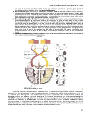 Arlindo Ugulino Netto – NEUROLOGIA – MEDICINA P6 – 2010.1


          em casos de aneurismas da artéria carótida interna, que comprimem lateralmente o quiasma óptico. Quando a
          compressão se faz dos dois lados, temos uma hemianospisa binasal.
       d) Lesão do tracto óptico (D): resulta em hemianopsia homônima direita ou esquerda, conforme a lesão se localize,
          respectivamente, no tracto óptico esquerdo ou direito. Traumatismos ou tumores que possam comprimir o tracto óptico
          geram esse tipo de lesão. Obstrução da artéria corióidea anterior, responsável pela nutrição do tracto óptico, também
          pode resultar nesta hemianopsia homônima (associada à hemiparesia devido ao fato de esta mesma artéria nutrir a
          perna posterior da cápsula interna, por onde passa o tracto córtico-espinhal).
       e) Lesões da radiação óptica (E): é fácil verificar, pelo trajeto das fibras na via óptica, que lesões completas da radiação
          óptica causam alterações de campo visual idênticas às que resultam de lesões do tracto óptico, ou seja, ocorrem
          hemianopsias homônimas. Pesquisando o reflexo fotomotor na metade cega da retina, verifica-se que ele está ausente
          no caso das lesões da radiação óptica (ou da área 17). Isto se explica pelo fato de que nas lesões do tracto óptico há
          interrupção das fibras retino-pré-tectais, o que não ocorre no caso das lesões situadas depois do corpo geniculado
          lateral. Lesões em regiões específicas da alça temporal (de Meyer) da radiação óptica (que ocorre frequentemente em
          cirurgias preventivas contra epilepsias, em que se retira o hipocampo, havendo, freqüentemente este tipo de lesão),
          pode haver perda de apenas um quadrante dos dois lados do campo visual. Este quadro é conhecido como
          quadrantanopsia (no caso da lesão da alça de Meyer, quadrantanopsia homônima superior do lado contralateral à
          lesão).
       f) Lesões do córtex visual (F): as lesões completas do córtex visual de um hemisfério dão alterações de campo iguais às
          observadas em lesões completas da radiação óptica.




        Para uma avaliação completa de todo o sistema óptico, o exame das pupilas também deve ser considerado,
avaliando, com isso, a integridade de sua inervação autonômica. No exame das pupilas, deve-se observar a forma e o
seu diâmetro. Uma diferença de 1 mm no tamanho das pupilas é considerada uma variante normal, aceitável. As
respostas pupilares são testadas com uma lanterna de luz brilhante. Normalmente, por uma resposta reflexa (ver
          4
REVISÃO ), a pupila normal reage à luz com constrição. Normalmente, a pupila contralateral também se contrai. Essas
respostas são chamadas de reação direta (por meio do reflexo fotomotor direto) e reação consensual (reflexo
fotomotor cruzado ou consensual), respectivamente. As pupilas também se contraem quando se muda o foco de um
objeto distante para um objeto próximo (reflexo da acomodação) e durante a convergência dos olhos, como quando se
pede ao paciente que olhem para o seu nariz ou para um dedo aproximando do nariz.



                                                                                                                               11
 