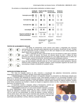 Arlindo Ugulino Netto; Luiz Gustavo Correia – OFTALMOLOGIA – MEDICINA P6 – 2010.1


       Os achados e a interpretação do teste estão sintetizados na tabela a seguir:




TESTES DE ALINHAMENTO OCULAR
                          Os testes de alinhamento ocular servem para testar a integridade dos músculos
                  extrínsecos do olho, inervados pelos seguintes nervos cranianos: Oculomotor (III par); Troclear
                  (IV par); Abducente (VI par). O desvio de um olho com relação ao outro indica paralisia de
                  algum deste nervo ou afecção muscular.
                          Para a realização do teste, pode-se fazer uso de uma lanterna e pedir para o paciente
                  que foque o olhar na mesma. Se houver um discreto desvio do olho, o reflexo do feixe
                  luminoso na córnea do paciente estará localizado em uma região diferente entre os olhos (ver
                  figura ao lado), quando normalmente, deveriam apresentar localização simétrica.
                          Pedir ao paciente que siga, com os olhos, os movimentos do dedo do examinador (ao
                  longo das seis posições cardinais) pode ser um bom exame para avaliar estrabismo. Deve-se
                  observar ainda a presença de qualquer nistagmo, sendo necessário registrá-lo de acordo com
                  sua presença, direção e amplitude em qualquer campo.




INSPEÇÃO EXTERNA DO OLHO
          Por meio da inspeção externa do olho, incluindo a visualização das pálpebras internamente, podemos
diagnosticar eventos como hordéolo, pterígeo, hemorragia subconjuntival, etc.
          O biomicroscopio (ou lâmpada de fenda) é um aparelho utilizado no ambulatório de oftalmologia utilizado para
este fim: a inspeção mais detalhada da superfície ocular. Este aparelho consiste em um microscópio acoplado a uma
fonte de luz, que permite ao examinador investigar patologias no segmento anterior e posterior do olho (para isto, deve-
se utilizar uma lente acessória específica). Com este aparelho, pode-se testar inclusive os reflexos pupilares. Existem
ainda lentes acessórias que facilitam o estudo do ângulo do segmento anterior do olho, importante para o estudo do
glaucoma, do ceratocone, etc.
          É importante, durante a inspeção, utilizar a fluoresceína, corante que
infiltra mesmo as pequenas soluções de continuidade no epitélio ocular.
          A tonometria consiste em um outro exame também realizado a propósito
da clínica oftalmológica, sendo importante por medir a pressão intraocular.
Depois de realizada a anestesia ocular, aplica-se sobre a córnea um aparelho
com um cone em sua extremidade, no intuito de aplanar a córnea. Quando a
córnea estiver plana, dois semi-círculos mostrados pelo aparelho (mira) entrarão
em contato (ver figura ao lado). De acordo com a força que foi aplicada pelo
examinador para planificar a córnea, infere-se a pressão intraocular.


                                                                                                                           14
 