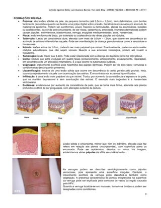 Arlindo Ugulino Netto; Luiz Gustavo Barros; Yuri Leite Eloy – DERMATOLOGIA – MEDICINA P8 – 2011.1



FORMAÇÕES SÓLIDAS
    Pápulas: s•o les†es s„lidas da pele, de pequeno tamanho (at‚ 0,5cm – 1,0cm), bem delimitadas, com bordas
     facilmente percebidas quando se desliza uma polpa digital sobre a les•o. Geralmente ‚ causada por acˆmulo de
     material na epiderme. Podem ser puntiformes, pouco maiores ou lenticuladas, planas ou acuminadas, isoladas
     ou coalescentes, da cor da pele circundante, de cor r„sea, castanha ou arroxeada. Inˆmeras dermatoses podem
     causar p…pulas: leishmaniose, blastomicose, verruga, erup€†es medicamentosas, acne, hansenƒase.
    Placa: les•o em forma de disco, por extens•o ou coalesc‰ncia de v…rias p…pulas ou n„dulos.
    Tubérculo: Les•o de consist‰ncia dura, elevada com mais de 0,5cm – 1,0cm, que ocorre em decorr‰ncia do
     acˆmulo de c‚lulas inflamat„rias na pele. Pode ser manifesta€•o de doen€a granulomatosa como a sarcoidose e
     hansenƒase.
    Nódulo: les†es acima de 1,0cm, podendo ser mais palp…vel que visƒvel. Eventualmente, podemos ainda avaliar
     n„dulos subcut‡neos, que n•o sejam visƒveis. Quanto a sua extens•o histol„gica, podem at‚ invadir a
     hipoderme.
    Tumoração: les•o maior que 3,0cm. Pode estar relacionada com a doen€a de dep„sito como no tofo gotoso.
    Goma: n„dulo que sofre evolu€•o em quatro fases (endurecimento, amolecimento, esvaziamento, repara€•o),
     em decorr‰ncia de um processo inflamat„rio. Ž a que ocorre na tuberculose cut‡nea.
    Vegetação: crescimento exofƒtico pela hipertrofia das papilas d‚rmicas. Podem ser de dois tipos: verrucosa e
     condilomatosa (esta quando presente).
    Liquenificação: trata-se de uma les•o s„lida que ocorre em decorr‰ncia do atrito gerado pelo prurido. Nela,
     ocorre o espessamento da pele com acentua€•o das estrias. Ž encontrada nos eczemas liquenificados.
    Infiltração: ‚ uma les•o mais palp…vel do que visƒvel. Traduz por aumento da consist‰ncia e espessura da pele,
     que se mant‚m depressƒvel e sem acentua€•o das estrias. O exemplo mais sugestivo ‚ a hansenƒase
     virchowiana.
    Esclerose: evidencia-se por aumento da consist‰ncia da pele, que se torna mais firme, aderente aos planos
     profundos e difƒcil de ser pregueada, com altera€•o evidente da textura.




                                           Les•o s„lida e circunscrita, menor que 1cm de di‡metro, elevada (que faz
                                           relevo em rela€•o aos planos circunjacentes), com superfƒcie plana ou
                                           encurvada. Pode ser epid‚rmica, d‚rmica ou mista. Na imagem,
                                           evidenciamos v…rias pápulas da sƒfilis secund…ria tardia.




                                           As verrugas podem ser descritas semiologicamente como pápulas
                                           verrucosas, pois apresenta uma superfƒcie irregular. Contudo, o
                                           crescimento exofƒtico da verruga pode classific…-la tamb‚m como
                                           vegeta€•o. A presen€a caracterƒstica de pontos enegrecidos na superfƒcie
                                           da verruga pode ser explicada pela trombose de vasos da regi•o causada
                                           pelo HPV.
                                           Quando a verruga localiza-se em mucosas, tornam-se ˆmidas e podem ser
                                           designadas como condilomas.

                                                                                                                             9
 