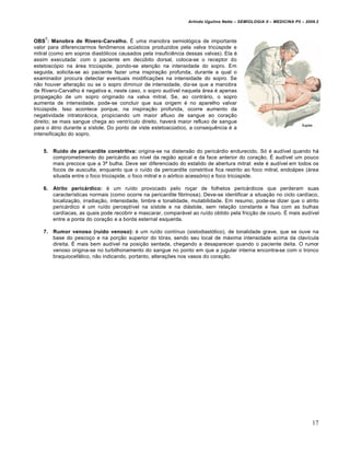 Arlindo Ugulino Netto – SEMIOLOGIA II – MEDICINA P5 – 2009.2



    7
OBS : Manobra de Rivero-Carvalho. É uma manobra semiológica de importante
valor para diferenciarmos fenômenos acústicos produzidos pela valva tricúspide e
mitral (como em sopros diastólicos causados pela insuficiência dessas valvas). Ela é
assim executada: com o paciente em decúbito dorsal, coloca-se o receptor do
estetoscópio na área tricúspide, pondo-se atenção na intensidade do sopro. Em
seguida, solicita-se ao paciente fazer uma inspiração profunda, durante a qual o
examinador procura detectar eventuais modificações na intensidade do sopro. Se
não houver alteração ou se o sopro diminuir de intensidade, diz-se que a manobra
de Rivero-Carvalho é negativa e, neste caso, o sopro audível naquela área é apenas
propagação de um sopro originado na valva mitral. Se, ao contrário, o sopro
aumenta de intensidade, pode-se concluir que sua origem é no aparelho valvar
tricúspide. Isso acontece porque, na inspiração profunda, ocorre aumento da
negatividade intratorácica, propiciando um maior afluxo de sangue ao coração
direito; se mais sangue chega ao ventrículo direito, haverá maior refluxo de sangue
para o átrio durante a sístole. Do ponto de viste estetoacústico, a consequência é a
intensificação do sopro.


    5.   Ruído de pericardite constritiva: origina-se na distensão do pericárdio endurecido. Só é audível quando há
         comprometimento do pericárdio ao nível da região apical e da face anterior do coração. É audível um pouco
         mais precoce que a 3ª bulha. Deve ser diferenciado do estalido de abertura mitral: este é audível em todos os
         focos de ausculta, enquanto que o ruído da pericardite constritiva fica restrito ao foco mitral, endoápex (área
         situada entre o foco tricúspide, o foco mitral e o aórtico acessório) e foco tricúspide.

    6.   Atrito pericárdico: é um ruído provocado pelo roçar de folhetos pericárdicos que perderam suas
         características normais (como ocorre na pericardite fibrinosa). Deve-se identificar a situação no ciclo cardíaco,
         localização, irradiação, intensidade, timbre e tonalidade, mutabilidade. Em resumo, pode-se dizer que o atrito
         pericárdico é um ruído perceptível na sístole e na diástole, sem relação constante e fixa com as bulhas
         cardíacas, as quais pode recobrir e mascarar, comparável ao ruído obtido pela fricção de couro. É mais audível
         entre a ponta do coração e a borda esternal esquerda.

    7.   Rumor venoso (ruído venoso): é um ruído contínuo (sistodiastólico), de tonalidade grave, que se ouve na
         base do pescoço e na porção superior do tórax, sendo seu local de máxima intensidade acima da clavícula
         direita. É mais bem audível na posição sentada, chegando a desaparecer quando o paciente deita. O rumor
         venoso origina-se no turbilhonamento do sangue no ponto em que a jugular interna encontra-se com o tronco
         braquiocefálico, não indicando, portanto, alterações nos vasos do coração.




                                                                                                                           17
 
