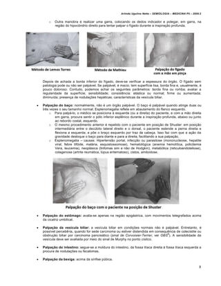 Arlindo Ugulino Netto – SEMIOLOGIA – MEDICINA P5 – 2009.2


        o   Outra manobra „ realizar uma garra, colocando os dedos indicador e polegar, em garra, na
            regi•o do hipocˆndrio direito para tentar palpar o f‚gado durante a inspira†•o profunda.




    Depois de achada a borda inferior do f‚gado, deve-se verificar a espessura do …rg•o. O f‚gado sem
    patologia pode ou n•o ser palpƒvel. Se palpƒvel, „ macio, tem superf‚cie lisa, borda fina e, usualmente, „
    pouco doloroso. Contudo, podemos achar os seguintes par‡metros: borda fina ou romba; avaliar a
    regularidade da superf‚cie; sensibilidade; consist‰ncia: elƒstica ou normal; firme ou aumentada;
    diminu‚da; presen†a de nodula†€es hepƒticas; caracter‚sticas da ves‚cula biliar.

   Palpação do baço: normalmente, n•o „ um …rg•o palpƒvel. O ba†o „ palpƒvel quando atinge duas ou
    tr‰s vezes o seu tamanho normal. Esplenomegalia reflete em abaulamento do flanco esquerdo.
         o Para palpƒ-lo, o m„dico se posiciona • esquerda (ou a direita) do paciente, e com a m•o direita
            em garra, procura sentir o p…lo inferior espl‰nico durante a inspira†•o profunda, abaixo ou junto
            ao rebordo costal, esquerdo.
         o O mesmo procedimento anterior „ repetido com o paciente em posi†•o de Shuster: em posi†•o
            intermediƒria entre o decŠbito lateral direito e o dorsal, o paciente estende a perna direita e
            flexiona a esquerda; e p€e o bra†o esquerdo por traz da cabe†a. Isso faz com que a a†•o da
            gravidade desloque o ba†o para diante e para a direita, facilitando a sua palpa†•o.
         o Esplenomegalia – causas: Hipertens•o portal, infec†•o ou parasitose (mononucleose, hepatite
            viral, febre tif…ide, malƒria, esquistossomose), hematol…gica (anemia hemol‚tica, policitemia
            Vera, leucemia), neoplƒsica (linfomas sim e n•o de Hodgkin), metab…lica (reticuloendoteliose),
            colagenose (artrite reumƒtica, lŠpus eritematoso), cistos, amiloidose.




   Palpação do estômago: avalia-se apenas na regi•o epigƒstrica, com movimentos telegrafados acima
    da cicatriz umbilical.

   Palpação da vesícula biliar: a ves‚cula biliar em condi†€es normais n•o „ palpƒvel. Entretanto, „
    poss‚vel perceb‰-la, quando for sede carcinoma ou estiver distendida em consequ‰ncia de colecistite ou
                                                                                    6
    obstru†•o biliar por carcinoma pancreƒtico (sinal de Corvoisier-Terrier, ver OBS ). A sensibilidade da
    ves‚cula deve ser avaliada por meio do sinal de Murphy no ponto c‚stico.

   Palpação do intestino: segue-se a moldura do intestino, da fossa il‚aca direita • fossa il‚aca esquerda a
    procura de nodula†€es ou fecalomas.

   Palpação da bexiga: acima da s‚nfise pŠbica.

                                                                                                               8
 