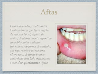 Aftas
Lesões ulceradas, recidivantes,
localizadas em qualquer região
da mucosa bucal, difíceis de
evitar, de aparecimento repentino
em adolescentes e adultos.
Iniciam-se sob forma de vesícula,
que logo rompe e forma uma
úlcera rasa, de fundo branco-
amarelado com halo eritematoso
e com dor queimante típica.
 