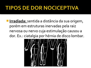  Irradiada: sentida a distância da sua origem,
porém em estruturas inervadas pela raiz
nervosa ou nervo cuja estimulação causou a
dor. Ex.: ciatalgia por hérnia de disco lombar.
 