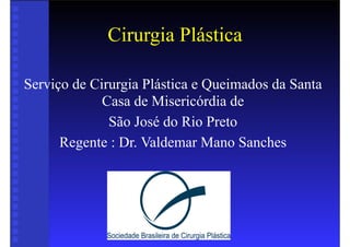 Cirurgia Plástica
Serviço de Cirurgia Plástica e Queimados da Santa
Casa de Misericórdia de
São José do Rio Preto
Regente : Dr. Valdemar Mano Sanches
 