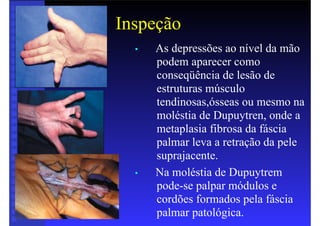 Inspeção
• As depressões ao nível da mão
podem aparecer como
conseqüência de lesão de
estruturas músculo
tendinosas,ósseas ou mesmo na
moléstia de Dupuytren, onde a
metaplasia fibrosa da fáscia
palmar leva a retração da pele
suprajacente.
• Na moléstia de Dupuytrem
pode-se palpar módulos e
cordões formados pela fáscia
palmar patológica.
 