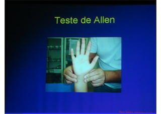 Semiologia da Mão.ppt.pdf