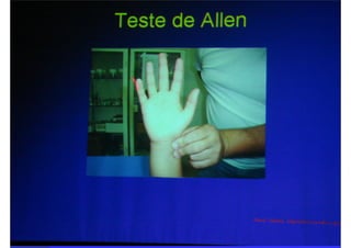 Semiologia da Mão.ppt.pdf