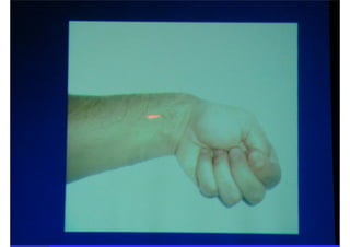 Semiologia da Mão.ppt.pdf