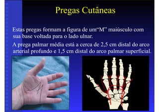 Pregas Cutâneas
Estas pregas formam a figura de um“M” maiúsculo com
sua base voltada para o lado ulnar.
A prega palmar média está a cerca de 2,5 cm distal do arco
arterial profundo e 1,5 cm distal do arco palmar superficial.
 