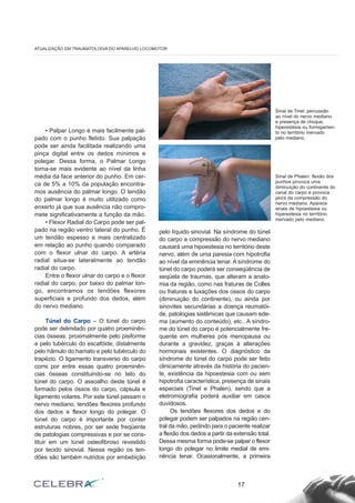 • Palpar Longo é mais facilmente pal-pado 
com o punho fletido. Sua palpação 
pode ser ainda facilitada realizando uma 
pinça digital entre os dedos mínimos e 
polegar. Dessa forma, o Palmar Longo 
torna-se mais evidente ao nível da linha 
média da face anterior do punho. Em cer-ca 
de 5% a 10% da população encontra-mos 
ausência do palmar longo. O tendão 
do palmar longo é muito utilizado como 
enxerto já que sua ausência não compro-mete 
significativamente a função da mão. 
• Flexor Radial do Carpo pode ser pal-pado 
na região ventro lateral do punho. É 
um tendão espesso e mais centralizado 
em relação ao punho quando comparado 
com o flexor ulnar do carpo. A artéria 
radial situa-se lateralmente ao tendão 
radial do carpo. 
Entre o flexor ulnar do carpo e o flexor 
radial do carpo, por baixo do palmar lon-go, 
encontramos os tendões flexores 
superficiais e profundo dos dedos, além 
do nervo mediano. 
Túnel do Carpo – O túnel do carpo 
pode ser delimitado por quatro proeminên-cias 
ósseas: proximalmente pelo pisiforme 
e pelo tubérculo do escafóide; distalmente 
pelo hâmulo do hamato e pelo tubérculo do 
trapézio. O ligamento transverso do carpo 
corre por entre essas quatro proeminên-cias 
ósseas constituindo-se no teto do 
túnel do carpo. O assoalho deste túnel é 
formado pelos óssos do carpo, cápsula e 
ligamento volares. Por este túnel passam o 
nervo mediano, tendões flexores profundo 
dos dedos e flexor longo do polegar. O 
túnel do carpo é importante por conter 
estruturas nobres, por ser sede freqüente 
de patologias compressivas e por se cons-tituir 
em um túnel osteofibroso revestido 
por tecido sinovial. Nessa região os ten-dões 
são também nutridos por embebição 
pelo líquido sinovial. Na síndrome do túnel 
do carpo a compressão do nervo mediano 
causará uma hipoestesia no território deste 
nervo, além de uma paresia com hipotrofia 
ao nível da eminência tenar. A síndrome do 
túnel do carpo poderá ser conseqüência de 
seqüela de traumas, que alteram a anato-mia 
da região, como nas fraturas de Colles 
ou fraturas e luxações dos ossos do carpo 
(diminuição do continente), ou ainda por 
sinovites secundárias a doença reumatói-de, 
patologias sistêmicas que causam ede-ma 
(aumento do conteúdo), etc.. A síndro-me 
do túnel do carpo é potencialmente fre-quente 
em mulheres pós menopausa ou 
durante a gravidez, graças à alterações 
hormonais existentes. O diagnóstico da 
síndrome do túnel do carpo pode ser feito 
clinicamente através da história do pacien-te, 
existência da hipoestesia com ou sem 
hipotrofia característica, presença de sinais 
especiais (Tinel e Phalen), sendo que a 
eletromiografia poderá auxiliar em casos 
duvidosos. 
Os tendões flexores dos dedos e do 
polegar podem ser palpados na região cen-tral 
da mão, pedindo para o paciente realizar 
a flexão dos dedos a partir da extensão total. 
Dessa mesma forma pode-se palpar o flexor 
longo do polegar no limite medial de emi-nência 
tenar. Ocasionalmente, a primeira 
17 
ATUALIZAÇÃO EM TRAUMATOLOGIA DO APARELHO LOCOMOTOR 
Sinal de Tinel: percussão 
ao nível do nervo mediano 
e presença de choque, 
hiperestesia ou formigamen-to 
no território inervado 
pelo mediano. 
Sinal de Phalen: flexão dos 
punhos provoca uma 
diminuição do continente do 
canal do carpo e provoca 
piora da compressão do 
nervo mediano. Aparece 
sinais de hipoestesia ou 
hiperestesia no território 
inervado pelo mediano. 
 