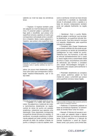saliente ao nível da base da eminência 
tenar. 
• Trapézio: O trapézio também pode 
ser palpado ao nível da tabaqueira anatô-mica. 
É possível palpar e perceber que 
logo após o escafóide, que possui uma 
superfície convexa, aparece um sulco que 
corresponde à articulação entre o escafói-de 
e o trapézio. Após o sulco, palpamos o 
trapézio, que possui uma superfície mais 
Palpação do complexo ulno-carpal (fibrocartilagem 
triangular) entre a apófise estilóide da ulna e o 
piramidal. 
plana. Um pouco mais distalmente, palpa-mos 
outro sulco que corresponde a articu-lação 
trapézio-metacarpiana, que é do 
tipo selar. 
• Capitato: é o maior dos ossos do 
carpo. Se palparmos o tubérculo de Lister 
e caminharmos distalmente na região 
central do dorso do punho em posição 
anatômica, notaremos que aparece uma 
depressão. Essa depressão corresponde 
à superfície dorsal côncava do capitato. O 
semilunar, na posição anatômica, é dificil-mente 
palpado por estar contido na fossa 
articular do rádio. Ao realizar a flexão do 
punho, a cabeça e o colo do capitato, bem 
como o semilunar, tornam-se mais dorsais 
e preenchem a cavidade ou depressão 
dorsal. A articulação entre o capitato e a 
base do terceiro metacarpiano também 
pode ser palpada facilmente na região 
dorsal. 
• Semilunar: Com o punho fletido, 
pode-se palpar o semilunar, que se proje-ta 
distalmente, na superfície articular dor-sal 
do punho. Sua face dorsal é convexa 
e é seguida, distalmente, pela superfície 
côncava do capitato. 
• Complexo Ulno Carpal: Distalmente 
ao processo estilóide da ulna pode-se pal-par 
a presença um tecido de consistência 
cartilaginosa na face medial do punho. 
Sabemos que, nos humanos, a ulna não 
se articula verdadeiramente com o carpo 
e, nessa região entre a extremidade distal 
da ulna e o carpo, encontramos uma série 
de estruturas que formam o complexo 
ulno carpal: fibrocartilagem triangular, e 
ligamentos ulno carpais (ulno-semilunar e 
ulno piramidal). 
• Piramidal: distalmente ao complexo 
ulno carpal, podemos palpar na face 
medial do carpo o piramidal que possui 
uma superfície convexa nessa região. 
• Pisiforme: É facilmente palpável na 
base da eminência hipotenar, na extremi-dade 
do tendão flexor ulnar do carpo. 
• Hamato: O hâmulo do hamato é ven-tral 
e pode ser palpado distal e lateral-mente 
ao pisiforme, ao nível da eminência 
tenar. Entre o pisiforme e o hâmulo do 
hamato localiza-se o canal de Guyon. 
Neste canal, que possui como limite late- 
20 
Fratura-avulsão da falange distal causando perda da 
ação motora do aparelho extensor. 
Palpação do piramidal na região medial do punho. 
 