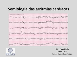 Semiologia das arritmias cardíacas
CM – Propedêutica
Unilus - 2020
Romeu Zugaiar Buchala Liger
 