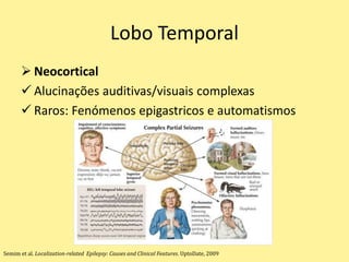 Lobo Temporal
 Neocortical
 Alucinações auditivas/visuais complexas
 Raros: Fenómenos epigastricos e automatismos
Semim et al. Localization-related Epilepsy: Causes and Clinical Features. UptoDate, 2009
 