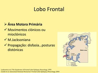 Lobo Frontal
 Área Motora Primária
 Movimentos clónicos ou
mioclónicos
 M.Jacksoniana
 Propagação: disfasia…posturas
distónicas
Laskowitz et al. The Syndrome of Frontal Lobe Epilepsy, Neurology, 1995
Combi et al. Autosomal Dominat Nocturnal Frontal Lobe Epilepsy, J Neurology, 2004
 