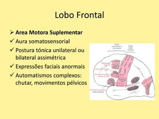 Lobo Frontal
 Area Motora Suplementar
 Aura somatosensorial
 Postura tónica unilateral ou
bilateral assimétrica
 Expressões faciais anormais
 Automatismos complexos:
chutar, movimentos pélvicos
 