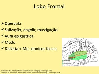 Lobo Frontal
Opérculo
Salivação, engolir, mastigação
Aura epigastrica
Medo
Disfasia + Mo. clonicos faciais
Laskowitz et al. The Syndrome of Frontal Lobe Epilepsy, Neurology, 1995
Combi et al. Autosomal Dominat Nocturnal Frontal Lobe Epilepsy, J Neurology, 2004
 
