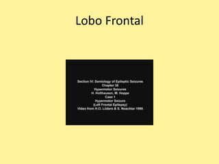 Lobo Frontal
 