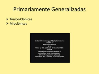 Primariamente Generalizadas
 Tónico-Clónicas
 Mioclónicas
 