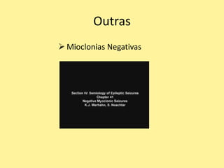 Outras
 Mioclonias Negativas
 