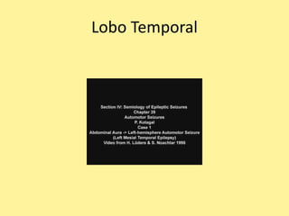 Lobo Temporal
 