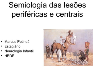 Semiologia das lesões 
periféricas e centrais 
• Marcus Petindá 
• Estagiário 
• Neurologia Infantil 
• HBDF 
 