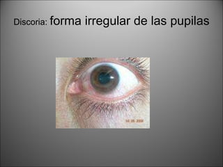 Semiologia De Cabeza I | PPT