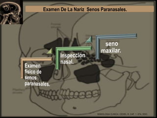 Examen De La Nariz Senos Paranasales.

SEMIOLOGIA CLINICA, CEDIEL R, CAP. 1. 6TA. EDIC.

 