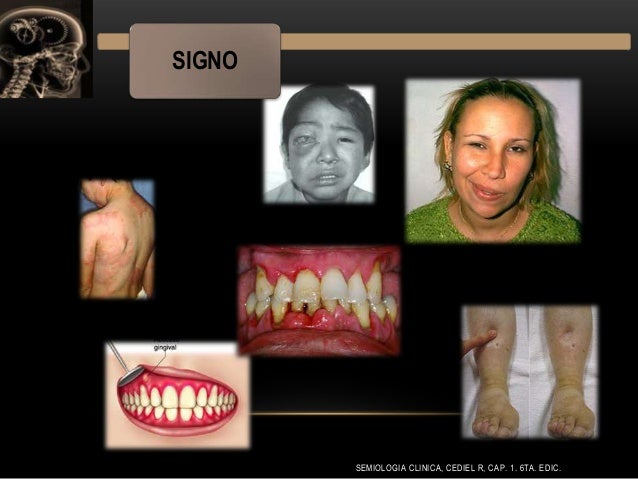 Semiologia Medica Cediel Descargar Pdf Viewer Semiologia Medica Cediel Descargar Pdf Viewer