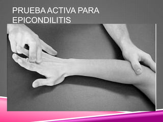 PRUEBA ACTIVA PARA
EPICONDILITIS
 