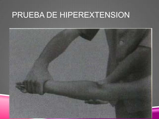PRUEBA DE HIPEREXTENSION
 