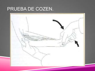 PRUEBA DE COZEN.
 