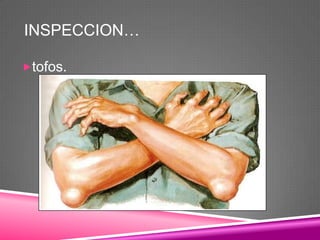 INSPECCION…

tofos.
 