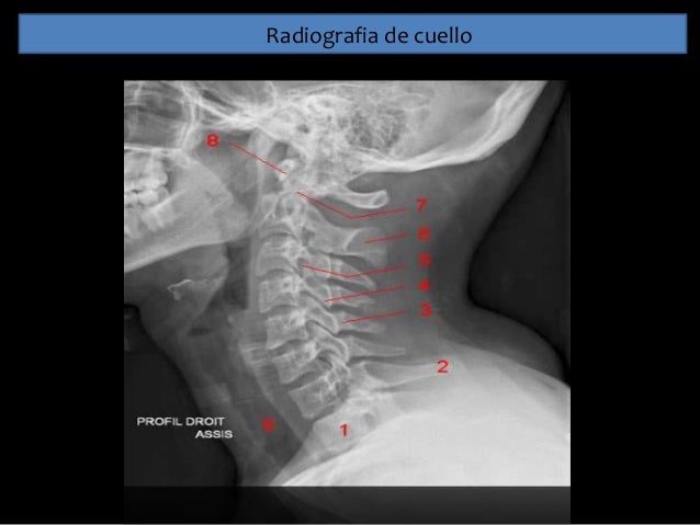 Semiologia de cuello